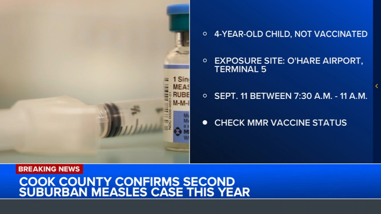 Measles case confirmed in Cook County, officials say child traveled through O'Hare