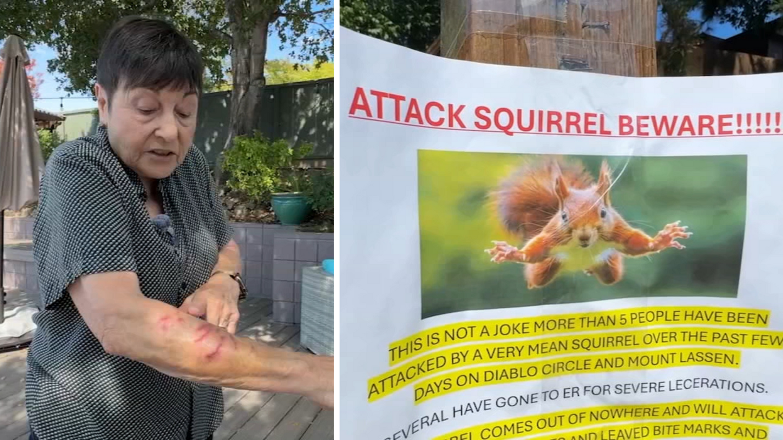 Vicious squirrel sends 2 San Rafael residents to ER after neighbors report series of attacks