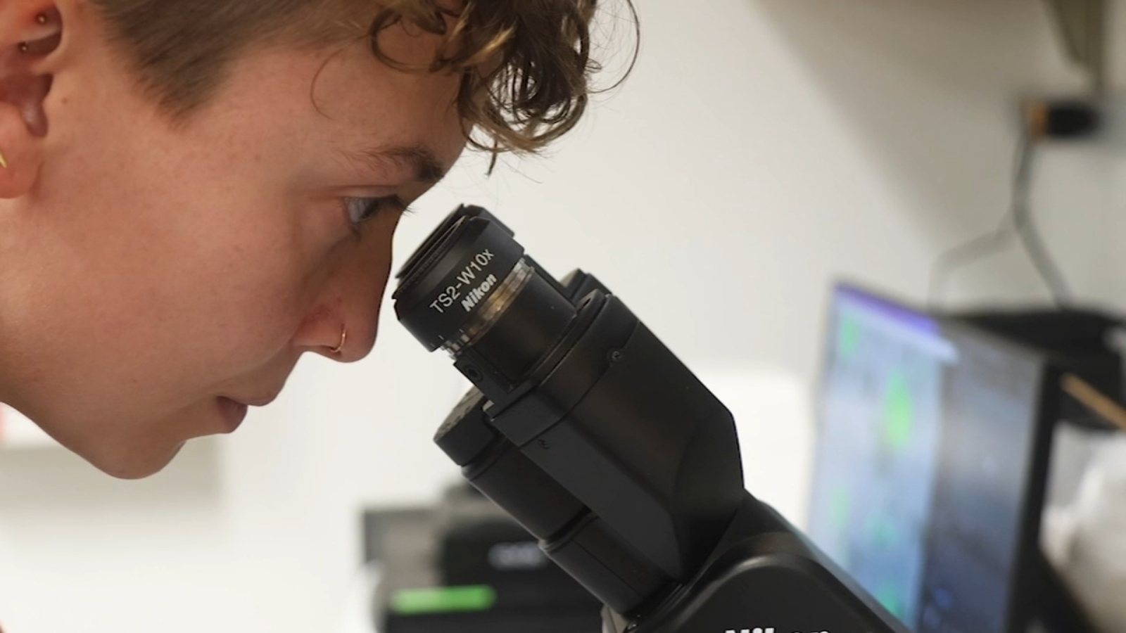 Duke researchers discover new origin of small cell lung cancer in study