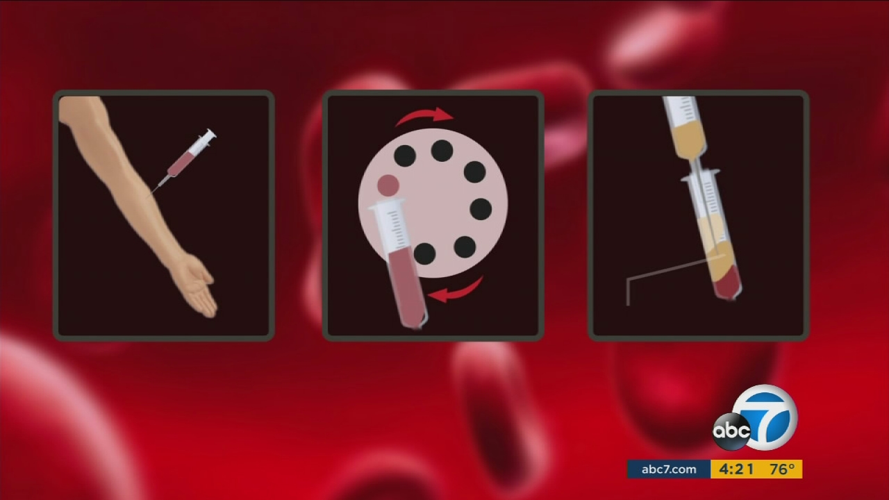 Breast cancer vaccine is 'game changer,' doctor says