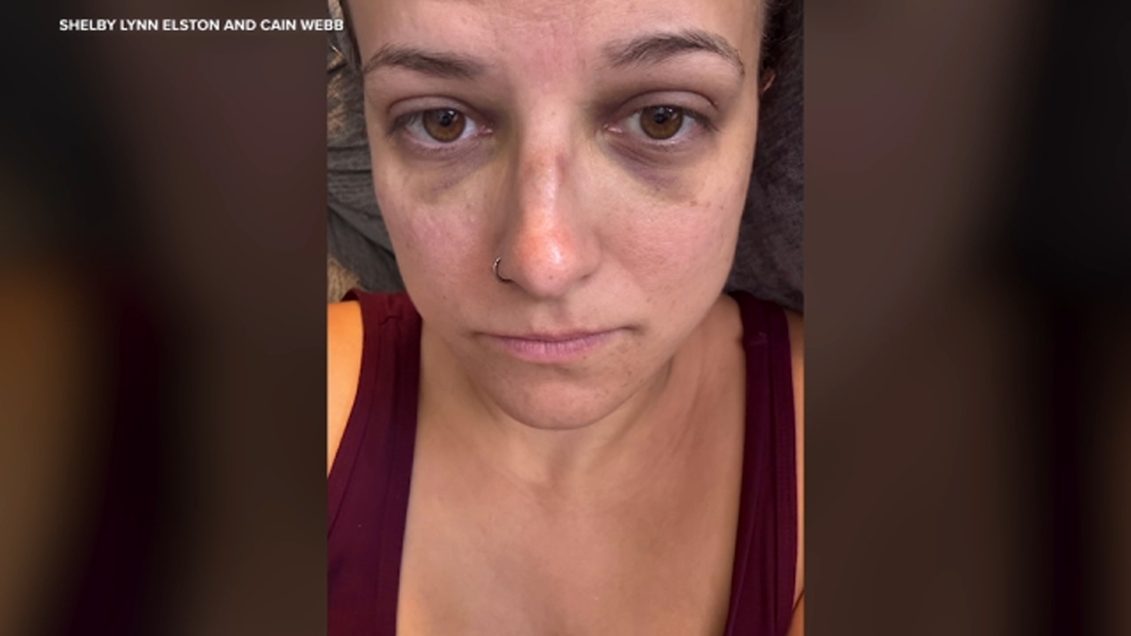 Woman beaten unconscious at Rose Bowl concert in Southern California sues venue, suspect