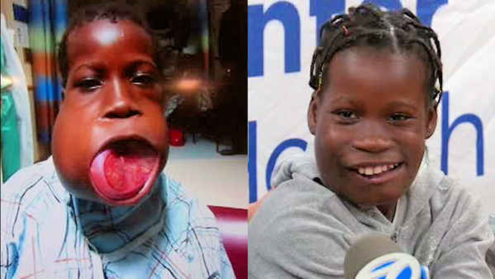 Girl from Africa thanks doctors after life-saving surgery