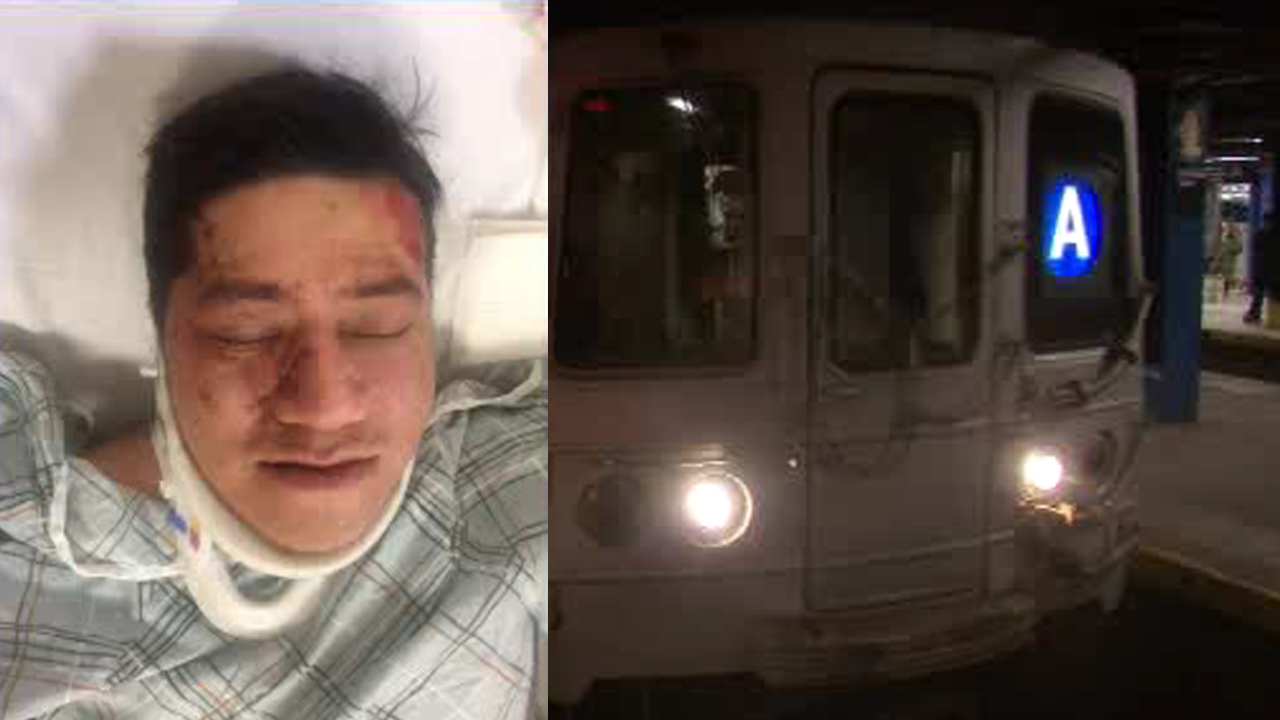 Man pushed down subway station stairs in random attack