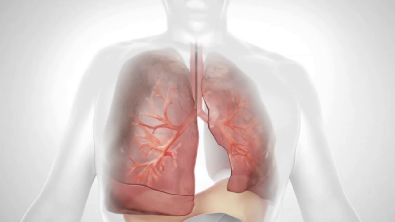 AI boosts clarity, information for chest CT scans