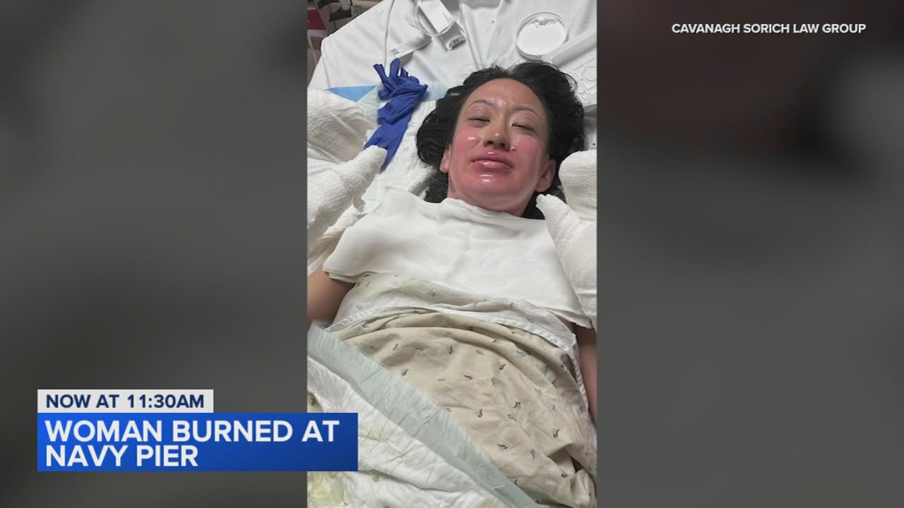Woman seriously injured by fire sues Navy Pier rooftop restaurant