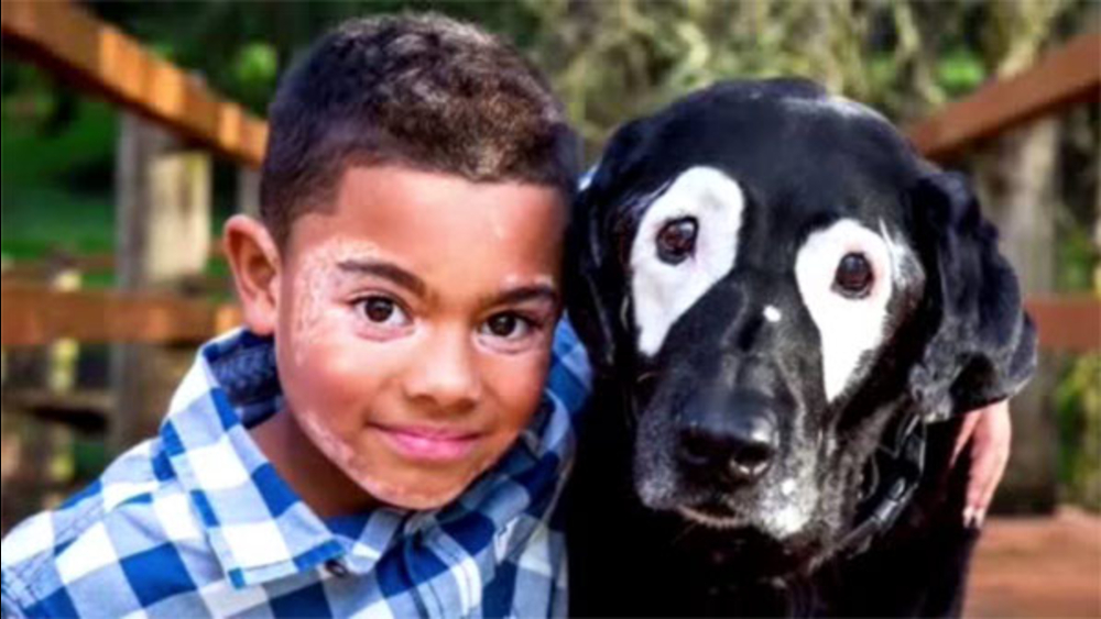 Boy with skin disorder befriends spotted dog
