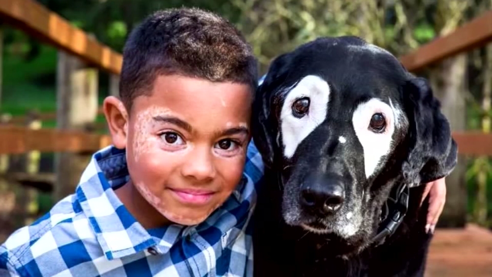 Oregon boy meets dog with same skin condition