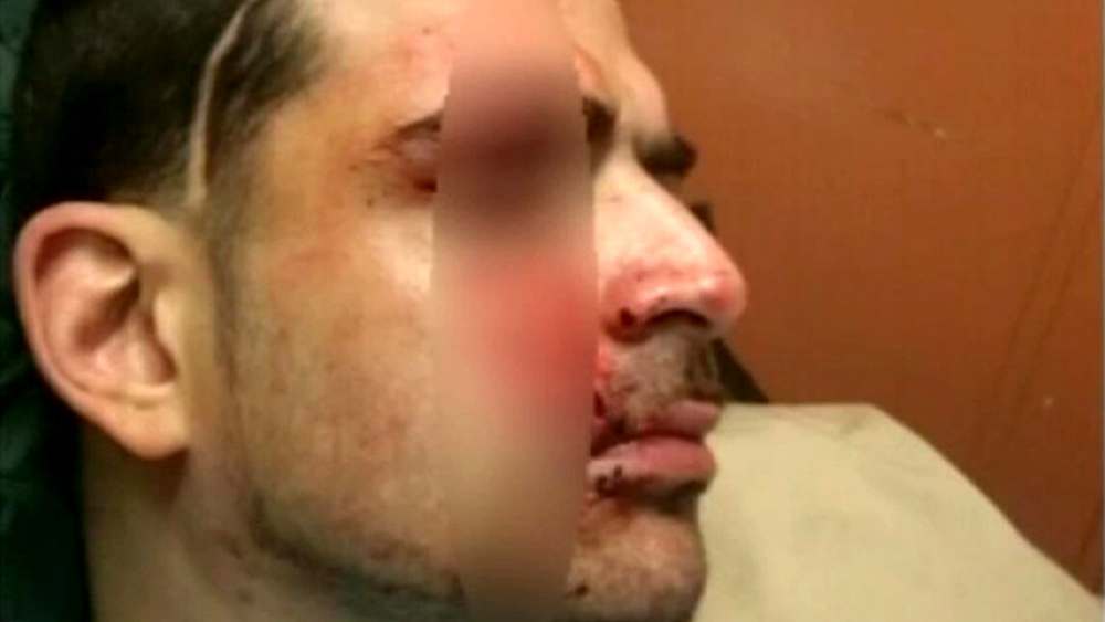 Rikers Island inmate slashed, picture shows up on Facebook