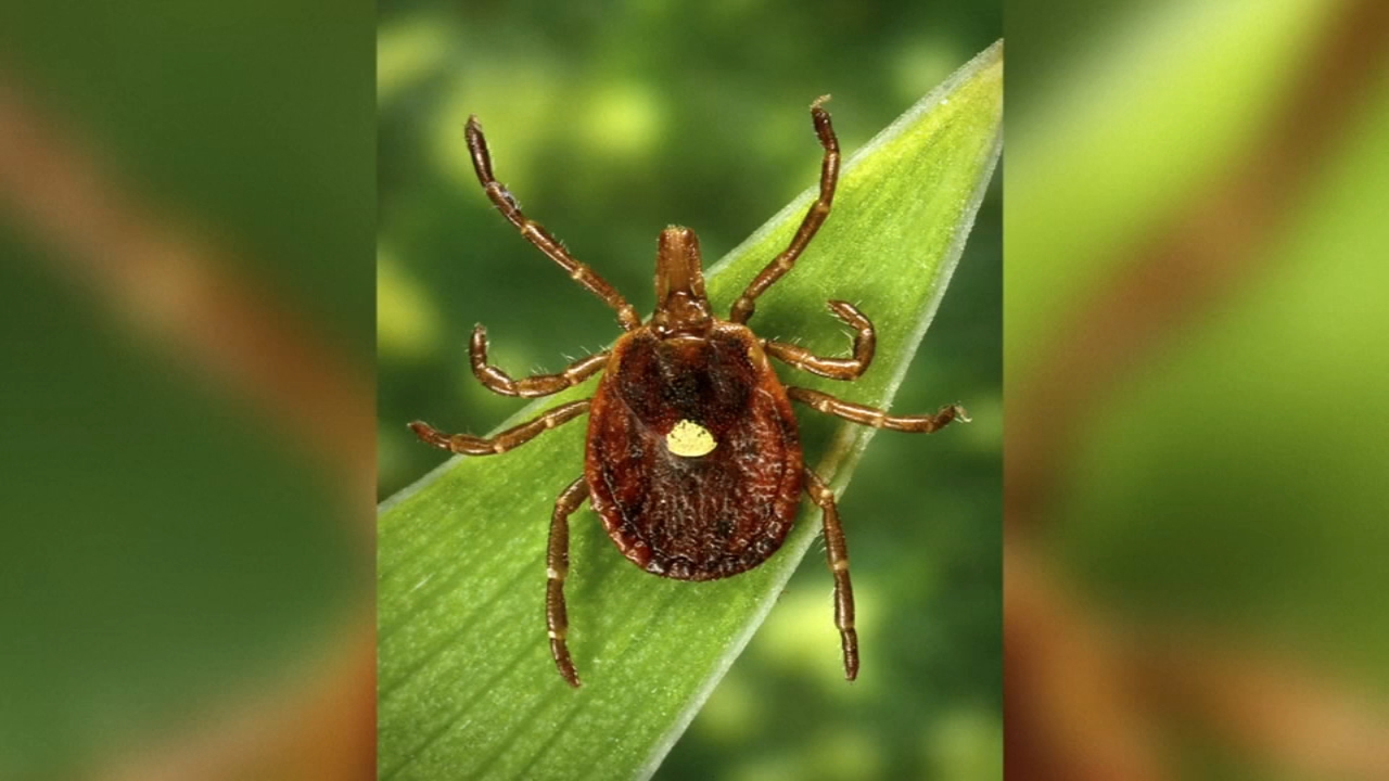 Alpha-gal Syndrome Death: NJ man believed to be 1st to die from meat allergy caused by a tick bite