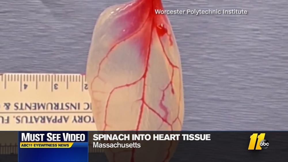 Scientists turn spinach leaves into heart tissue