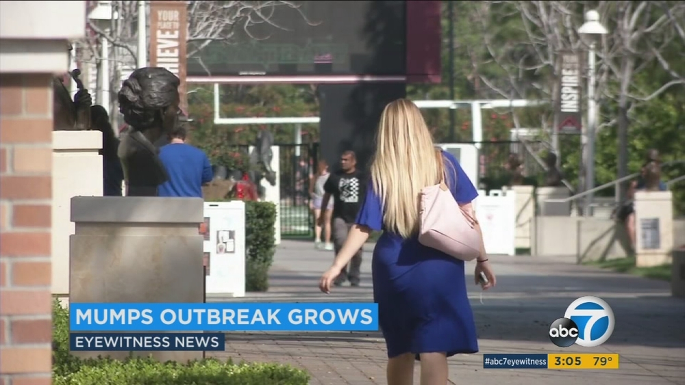 Mumps outbreak worsens at Orange County university