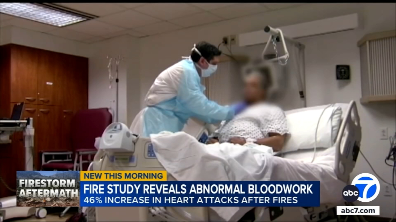 ER visits for heart attacks surged in aftermath of January's LA County wildfires, study shows