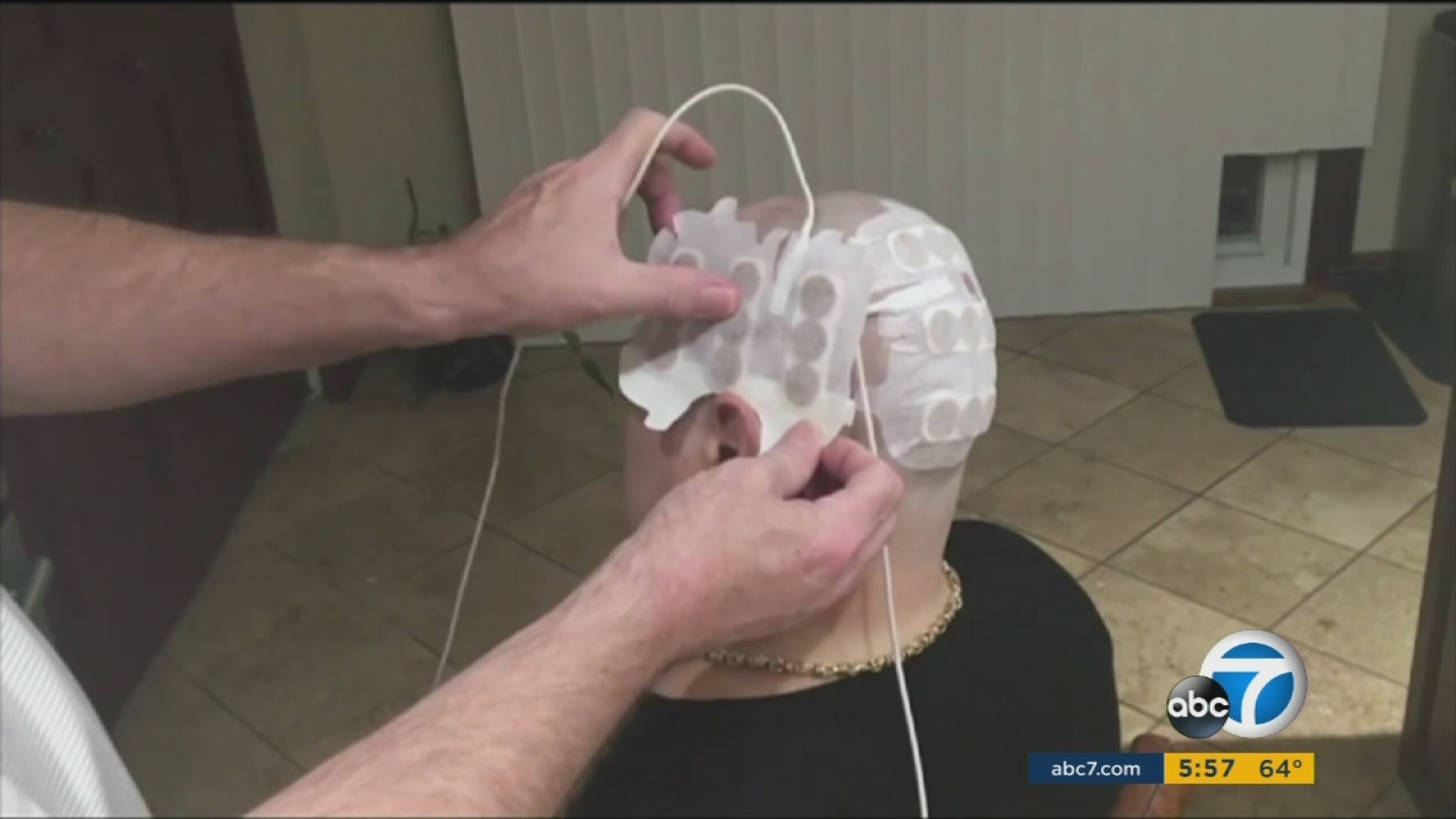 Device uses electricity to disrupt cells, improve brain cancer survival