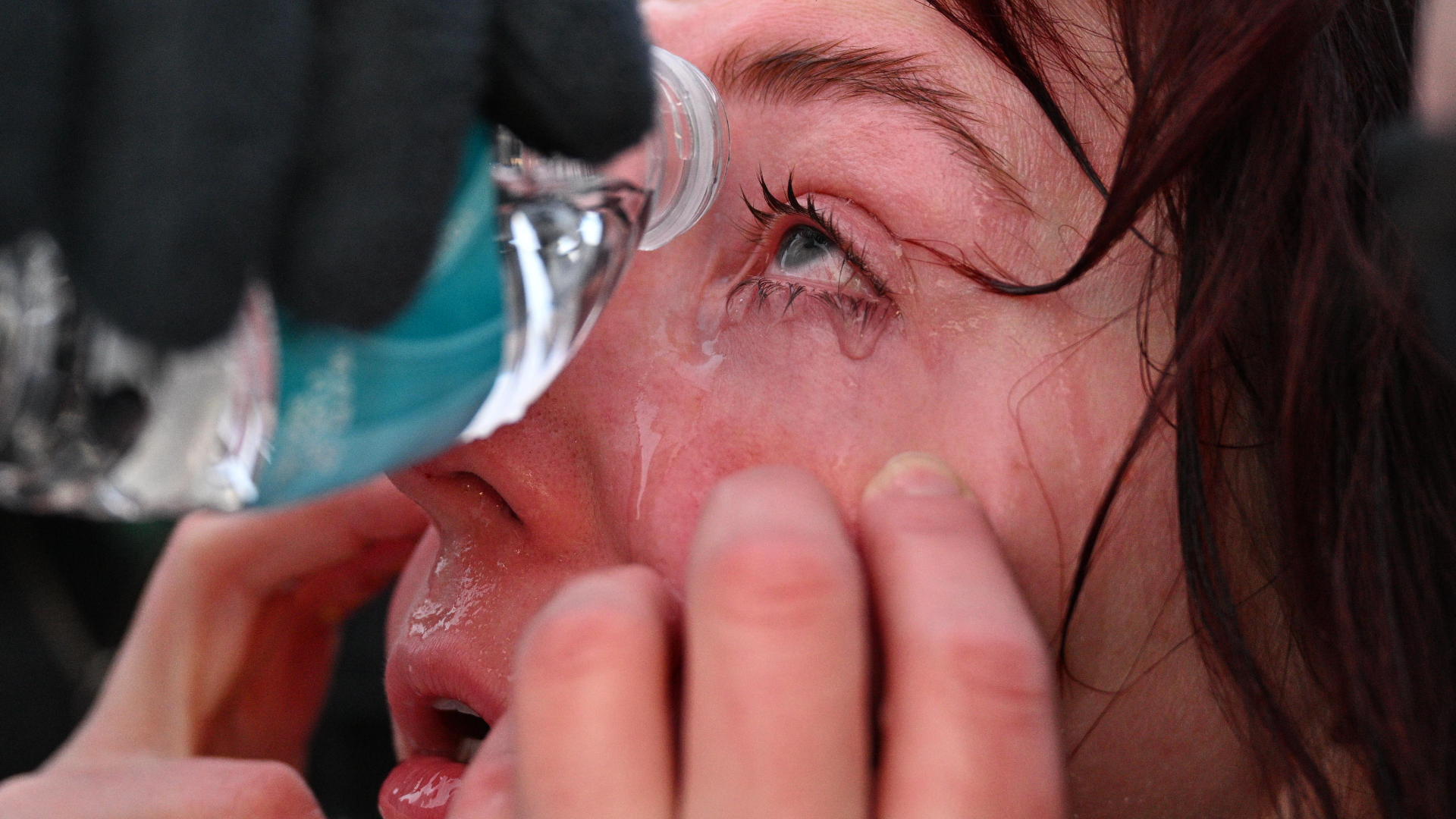 A protester receives aid after confronting law enforcement outside the Bishop Henry Whipple Federal Building, Thursday, Jan. 8, 2026, in Minneapolis, Minn.