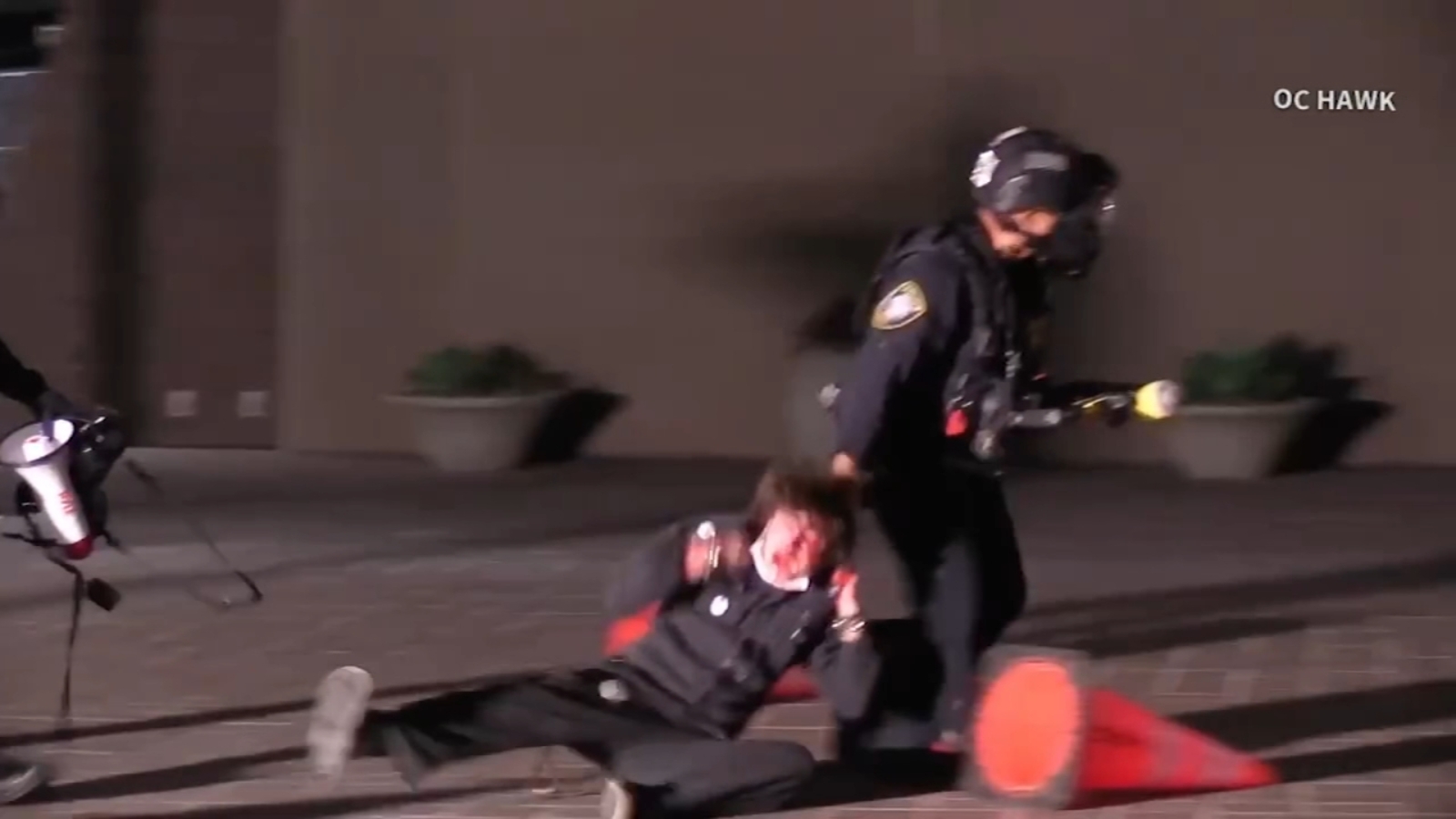 Protester blind in left eye after federal agent fired projectile during Santa Ana protest, family says Protester blind in left eye after federal agent fired projectile during Santa Ana protest, family says