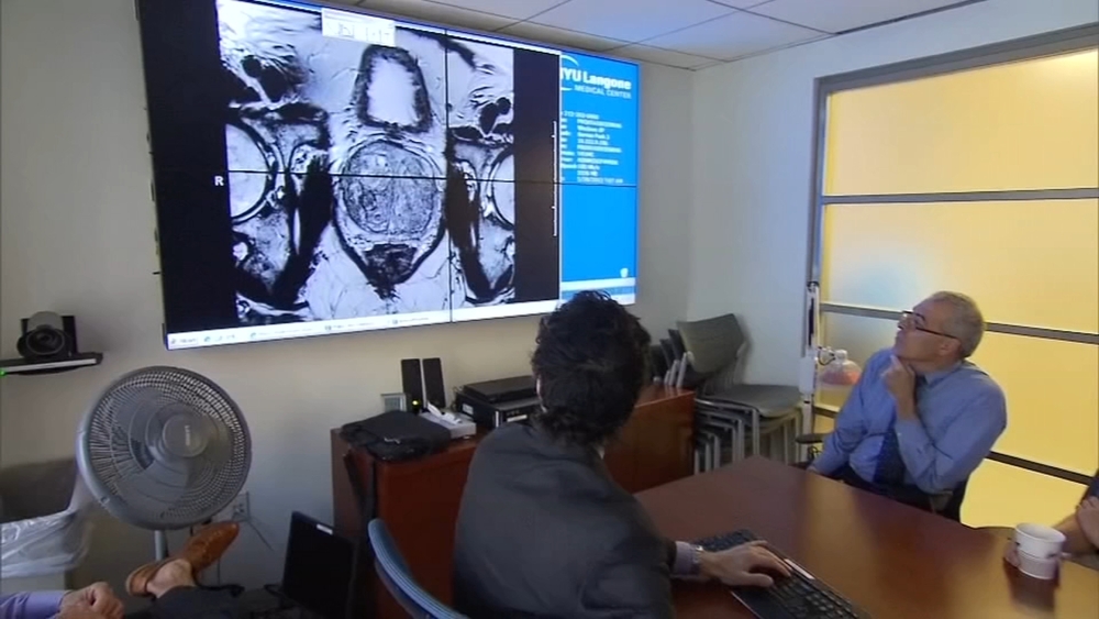 People living longer after cancer diagnosis, new data shows