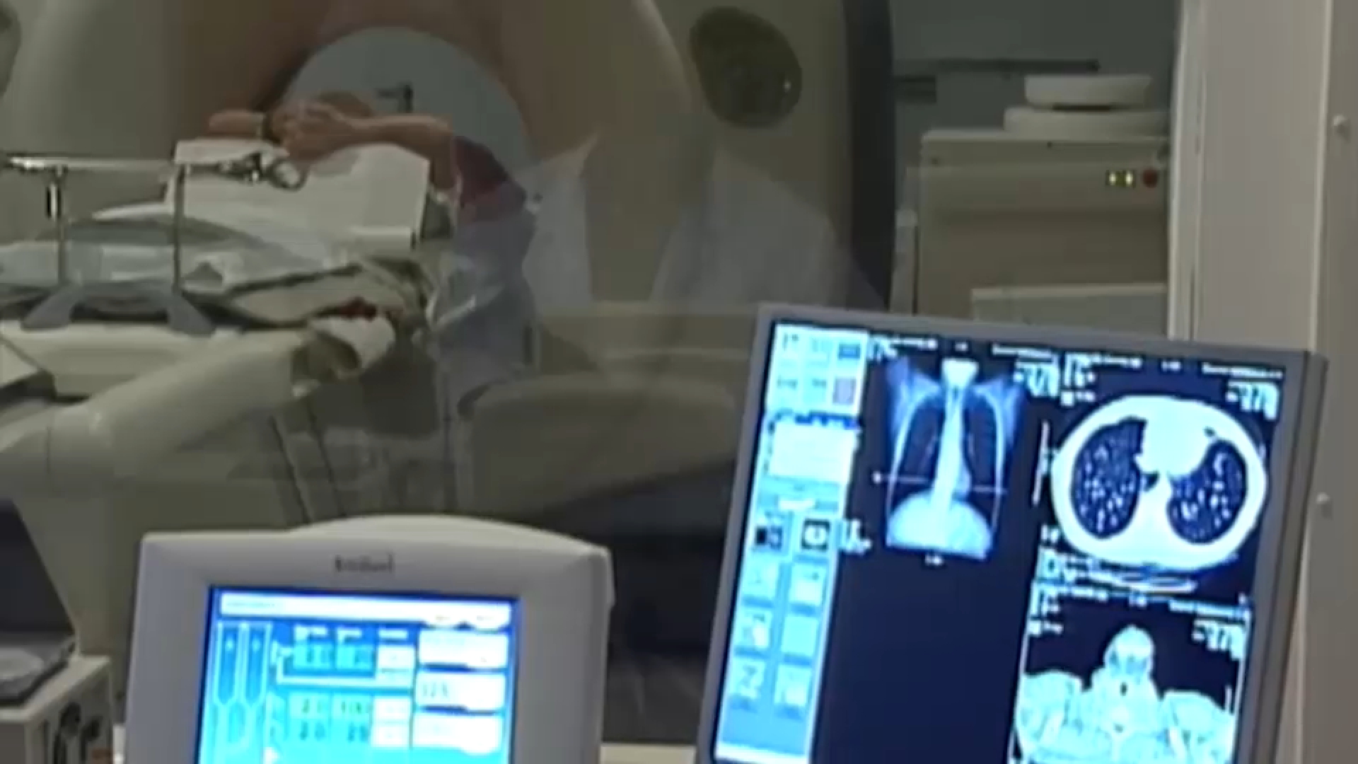 7 in 10 people surviving cancer for more than 5 years after diagnosis, report finds