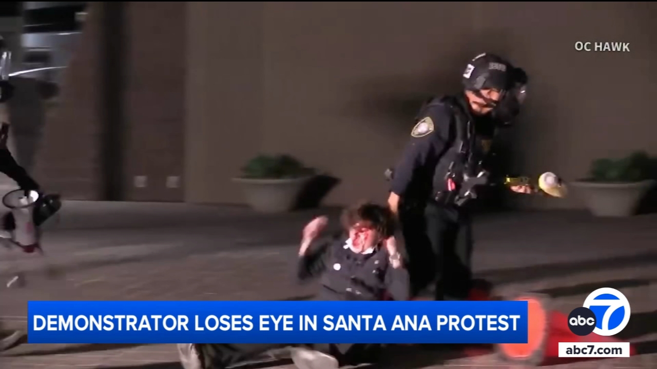 Protester blind in left eye after federal agent fired projectile during  Santa Ana protest, family says - ABC7 Los Angeles