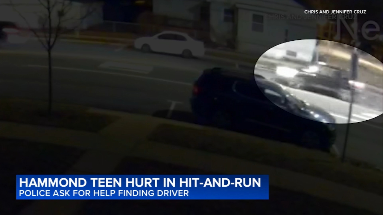 Hammond police search for hit-and-run driver that injured boy, 14