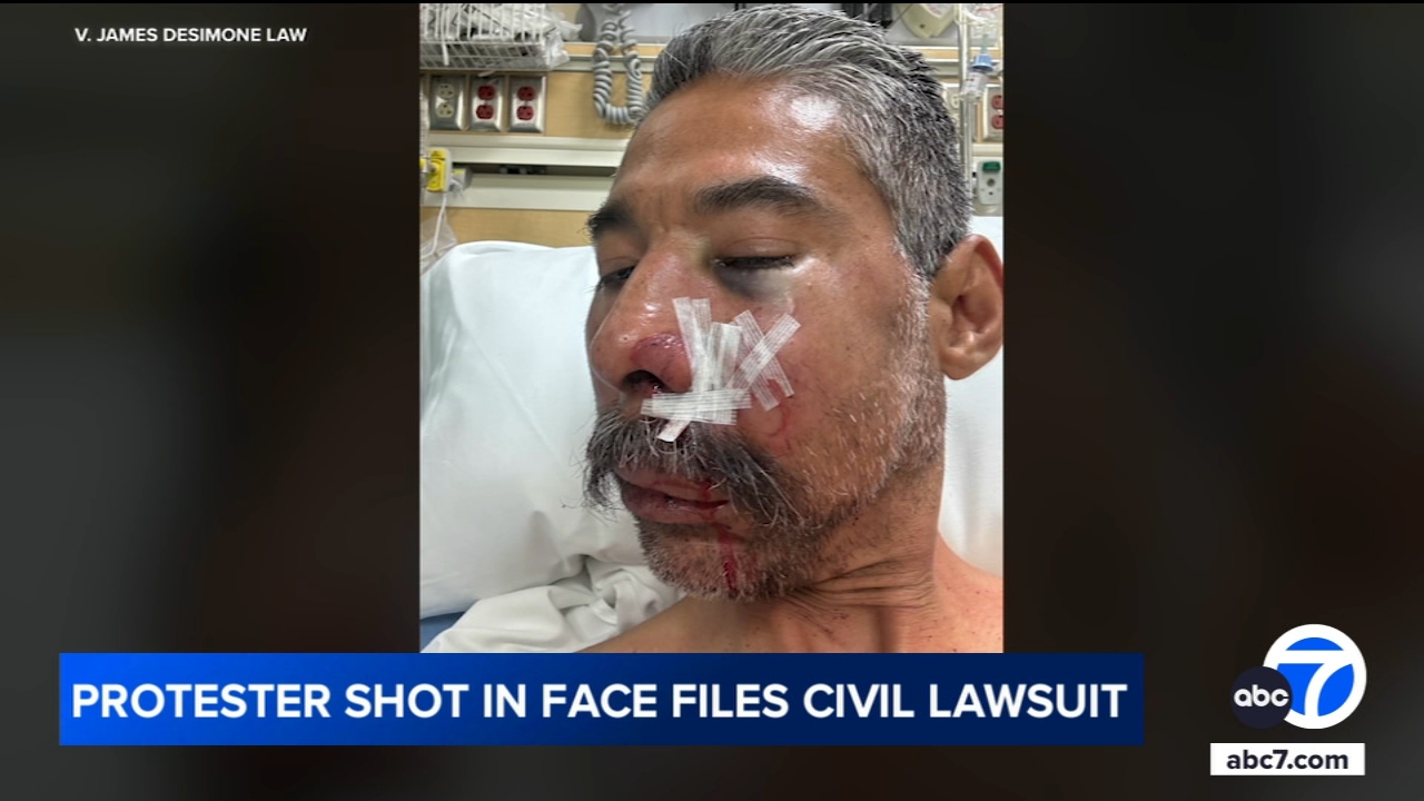 Protester shot in face with foam projectile during anti-ICE protest suing LAPD