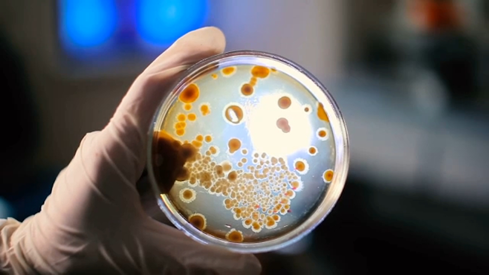 The unexpected way norovirus can spread through your household