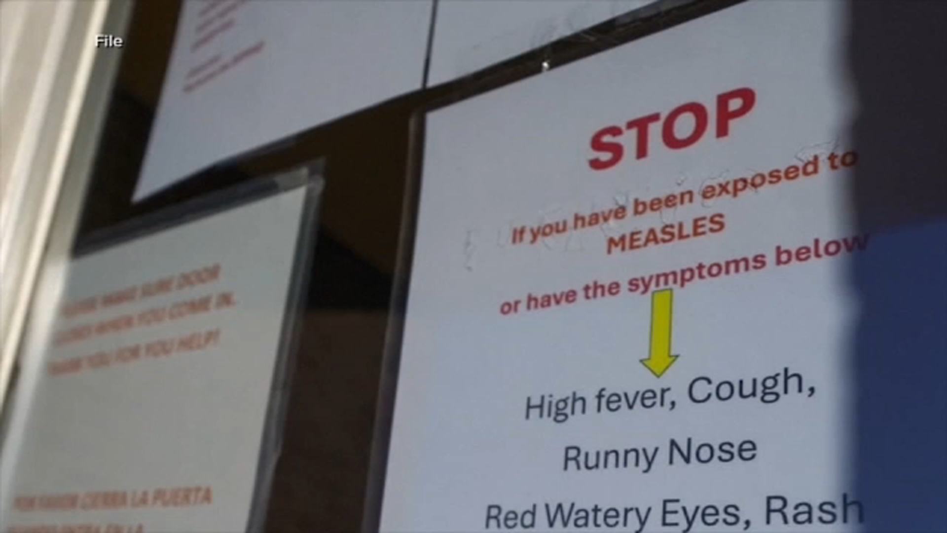 Measles alert: Confirmed cases in Wake, Durham, Johnston counties