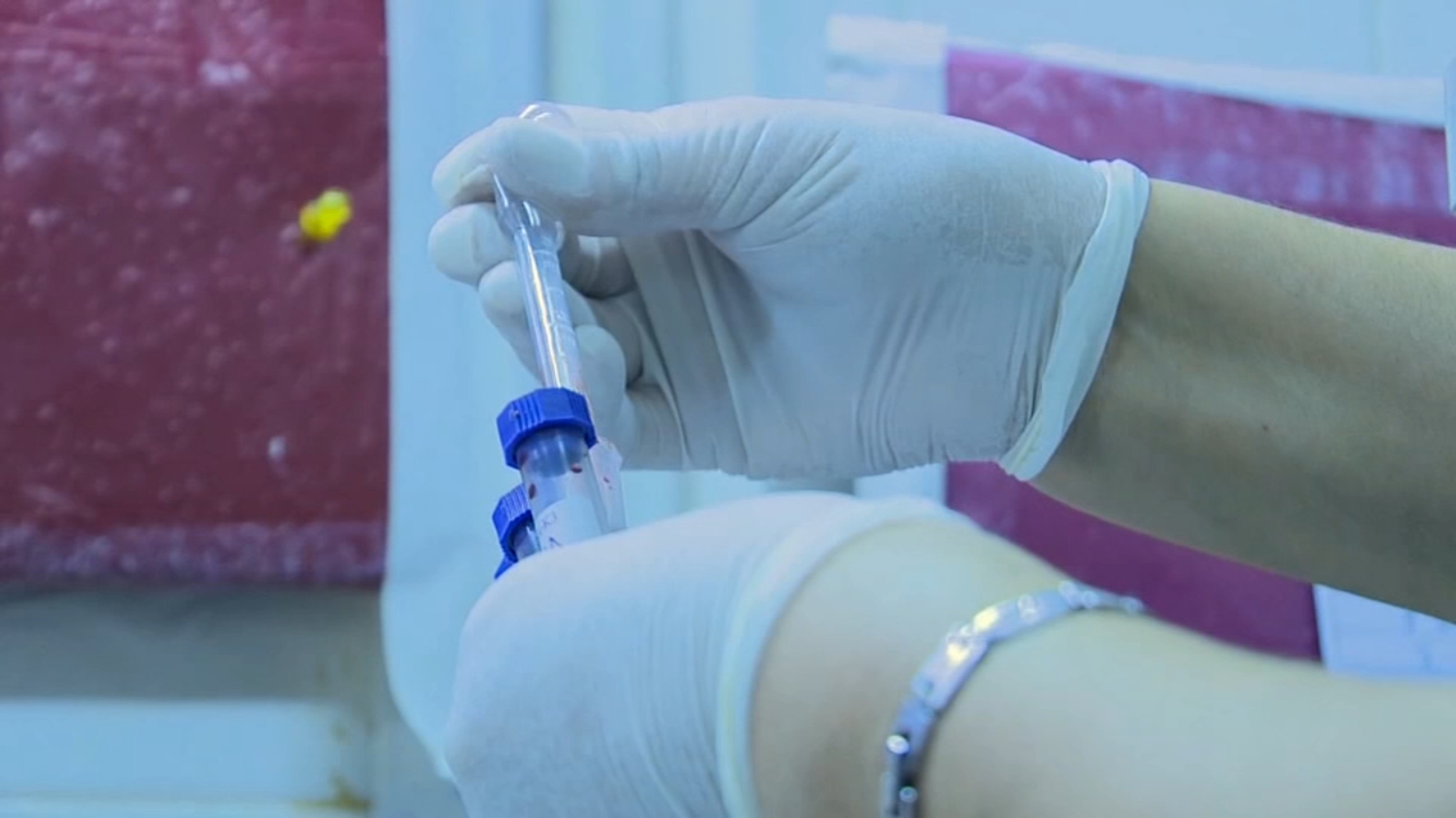 SF losing $8 million in HIV grant funding, impacting treatment and prevention services