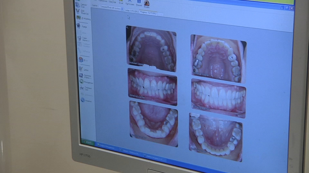 Importance of keeping good oral health