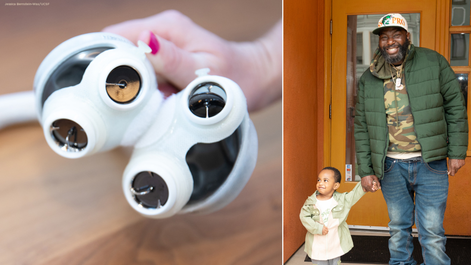 Cook surviving on artificial heart saved with donor heart in first-ever UCSF transplant