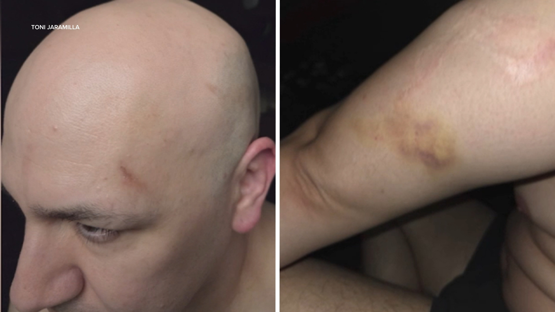 Man sues LAPD, alleging officers attacked him while he streamed ICE protest