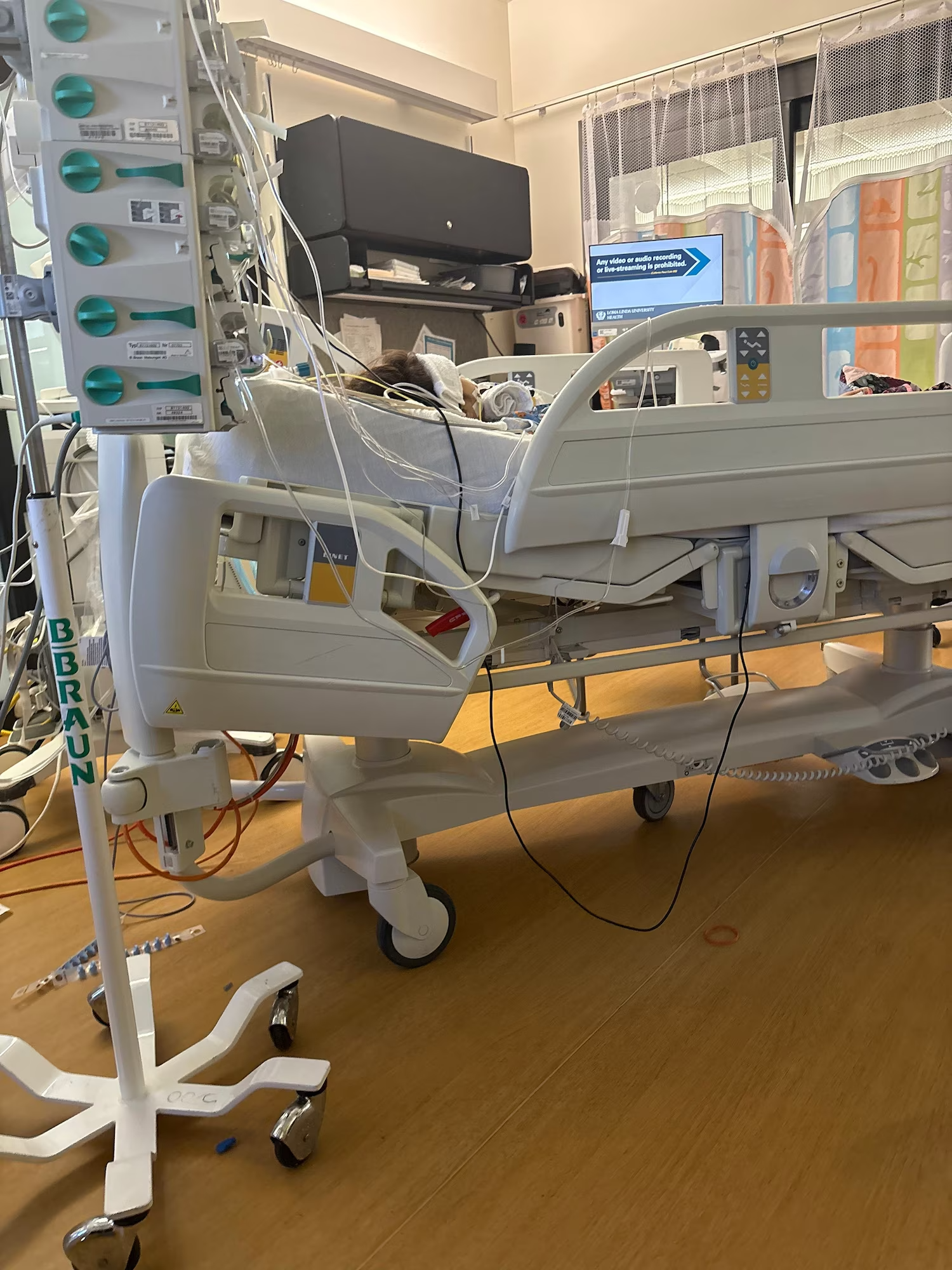 Camila Romero, 4, is receiving treatment at Loma Linda University Children's Hospital in Loma Linda, California, for a button battery injury and respiratory virus.