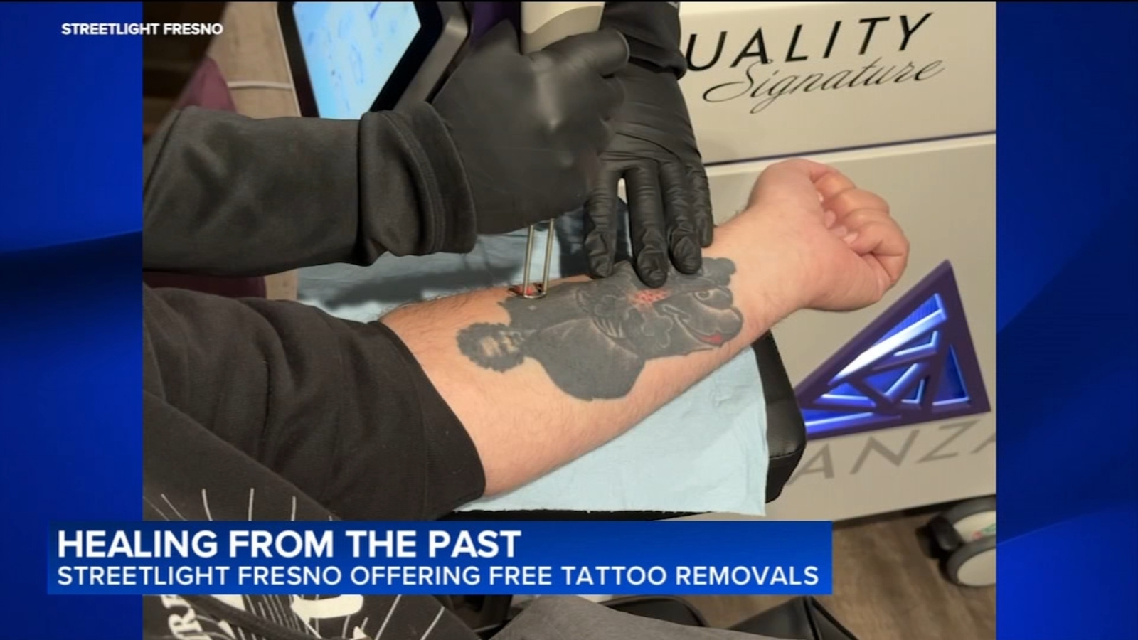 Local nonprofit offering free tattoo removal service