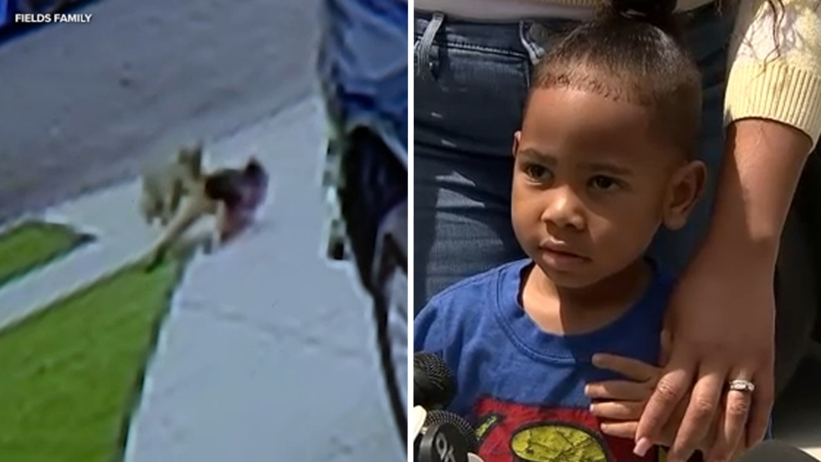 4-year-old boy attacked by coyote while standing in grandparents' California driveway: VIDEO