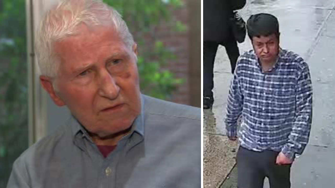 Elderly man randomly punched in face in Queens