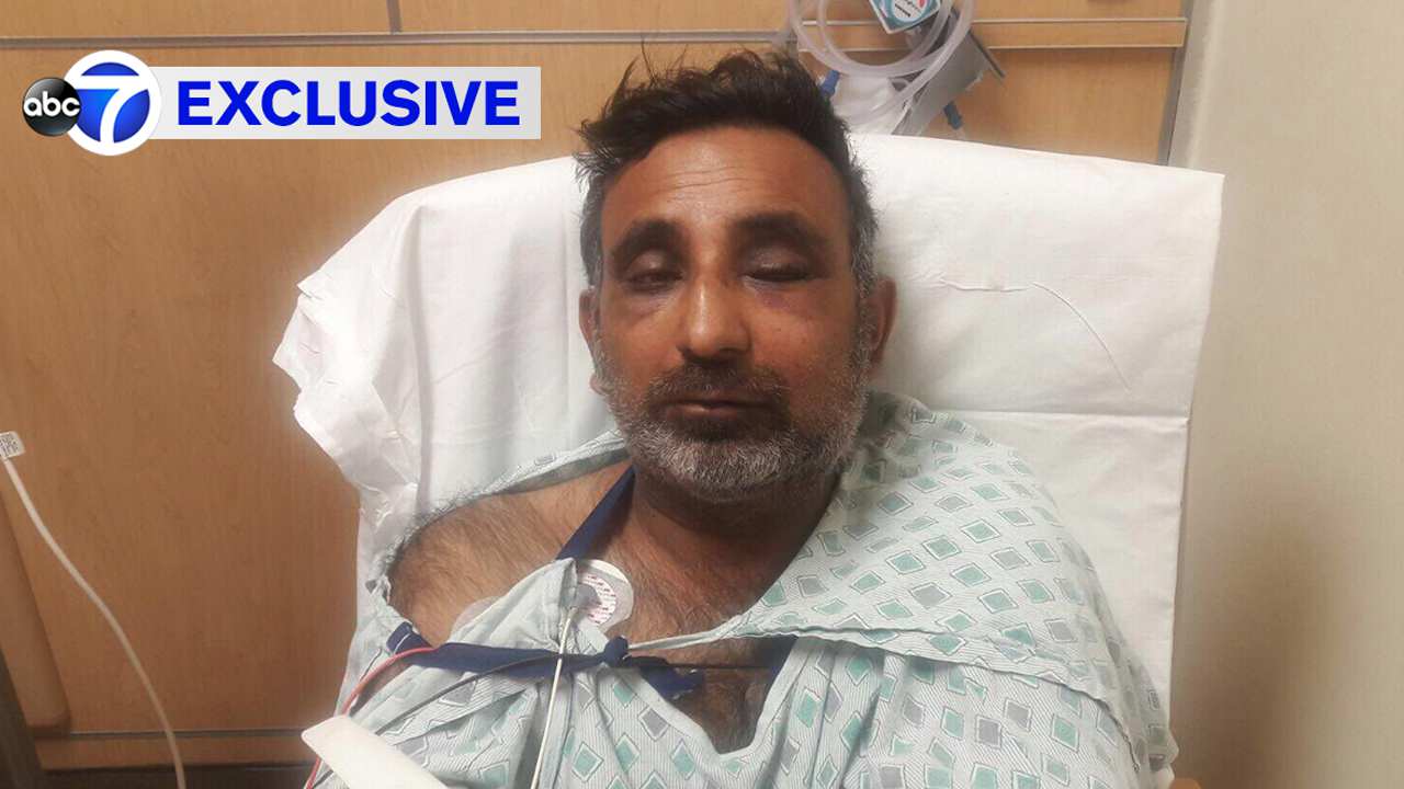 Exclusive: Livery driver brutally beaten on Long Island