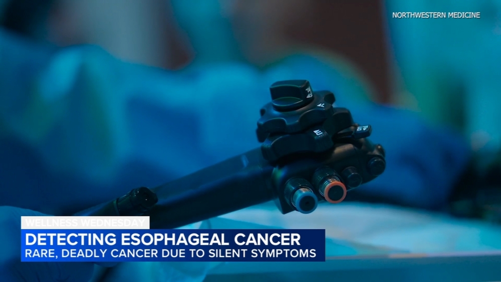 Detecting esophageal cancer