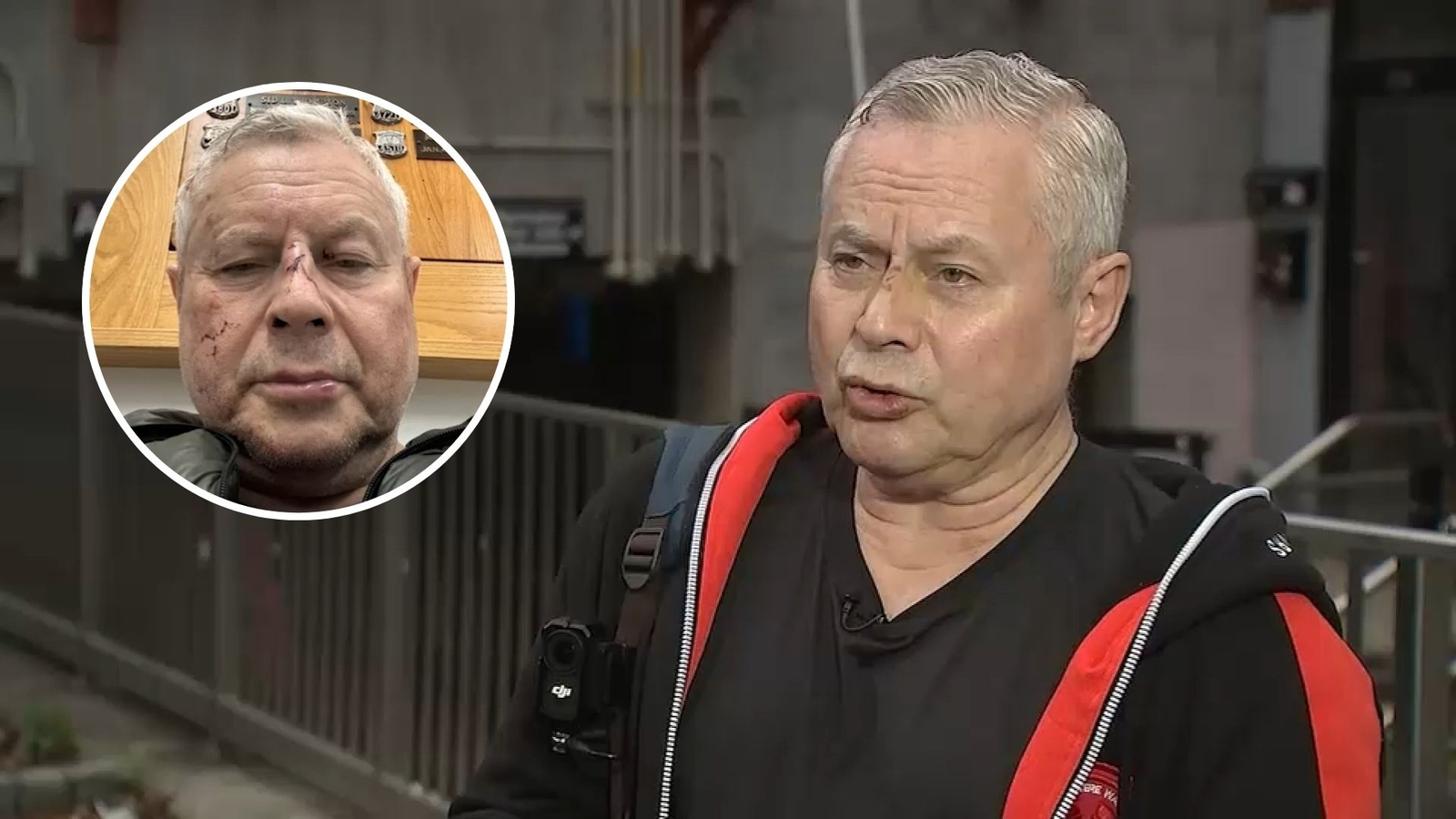 Subway robbery victim recounts attack, questions station safetyAnatoliy Suprun said he was sitting on an elevated platform at the Avenue H station early Friday morning, passing the time on his phone before his train arrived, when a thief gr