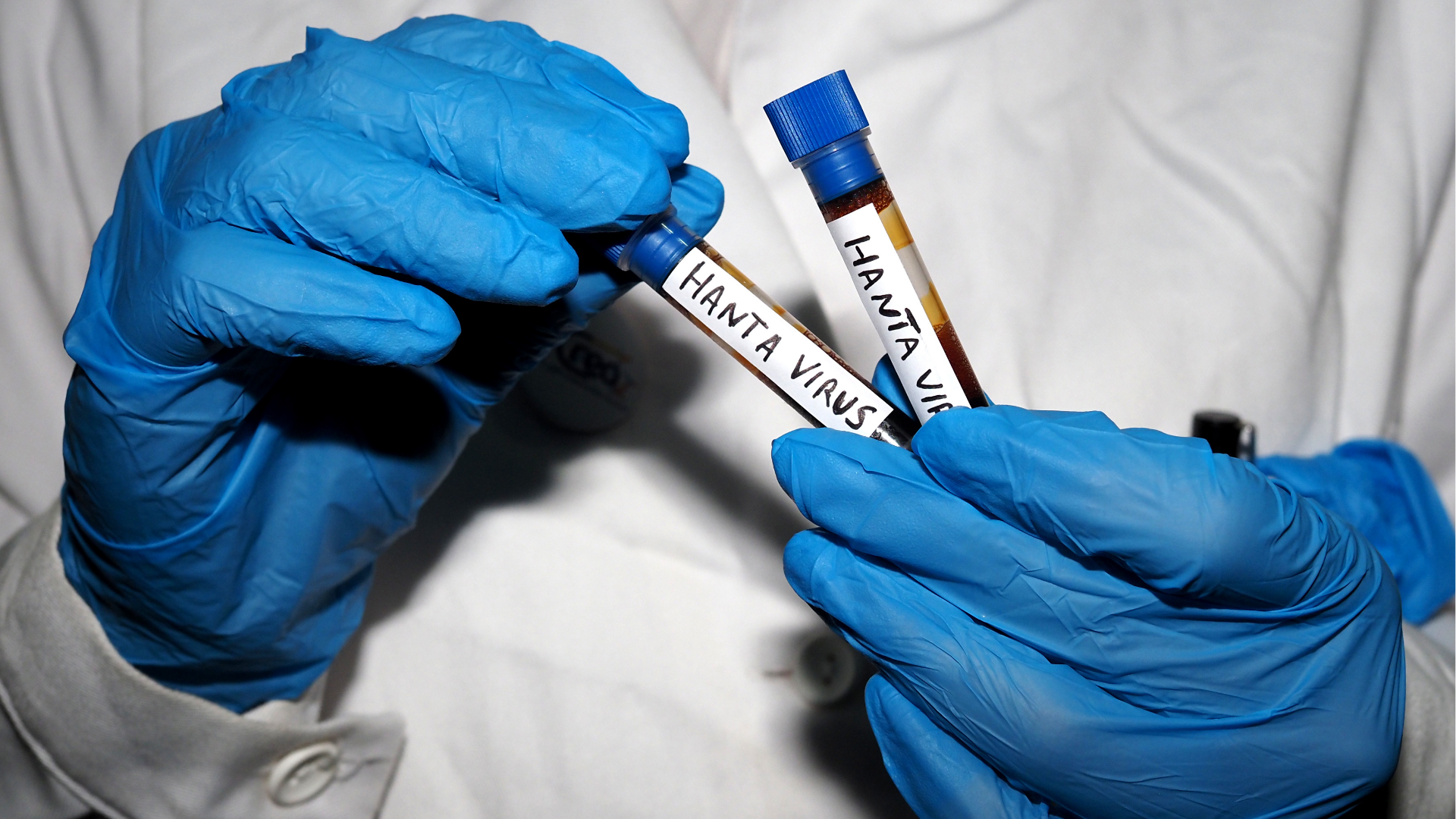In this photo illustration, a laboratory test tubes containing blood to be analyzed for the Hantavirus "Orthohantavirus" outbreak, held by a nurse.