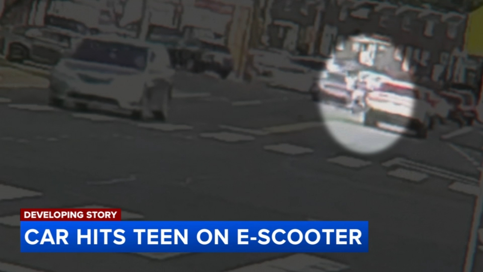 Teen on e‑scooter hospitalized after collision in Summerdale: Police