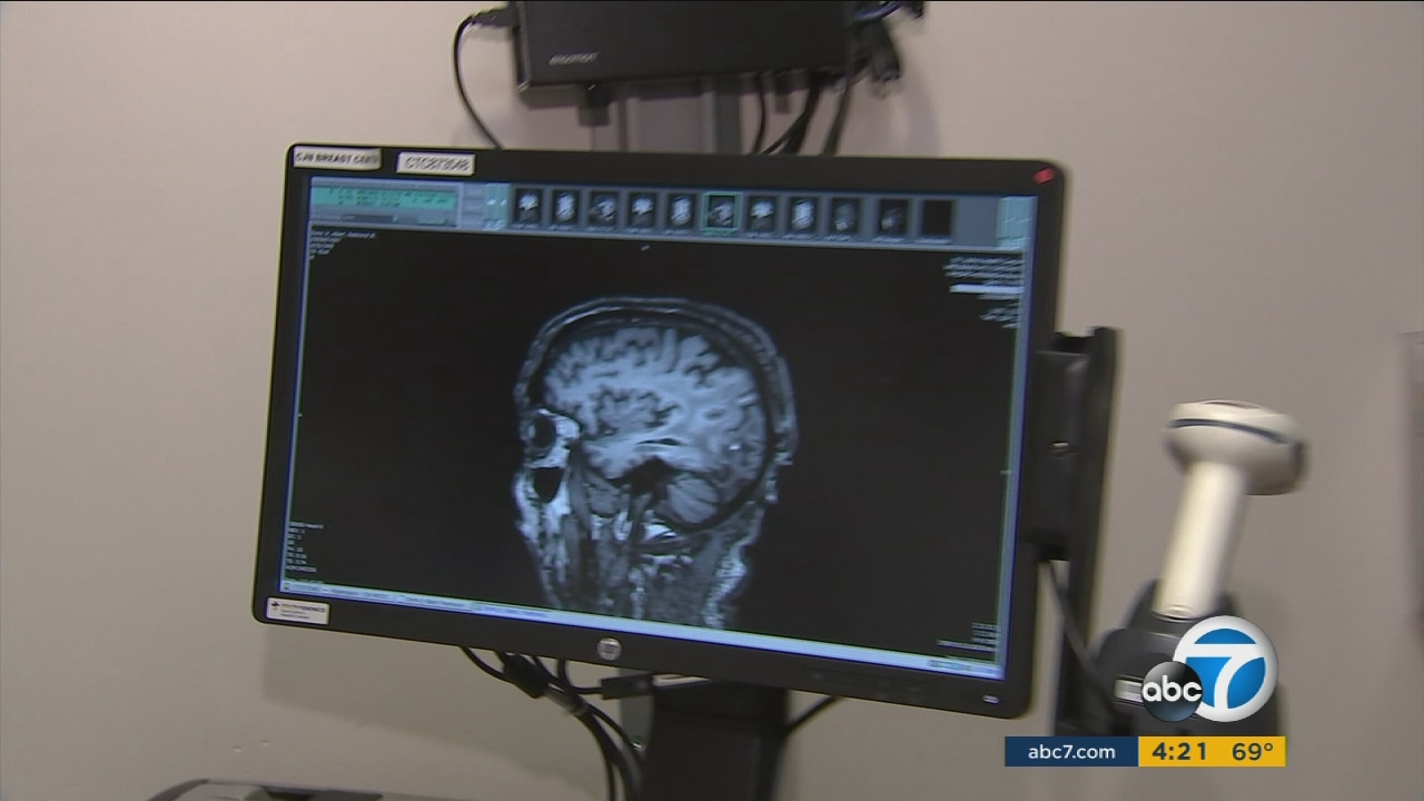 Targeted therapy being tested in SoCal gives brain cancer patients hope