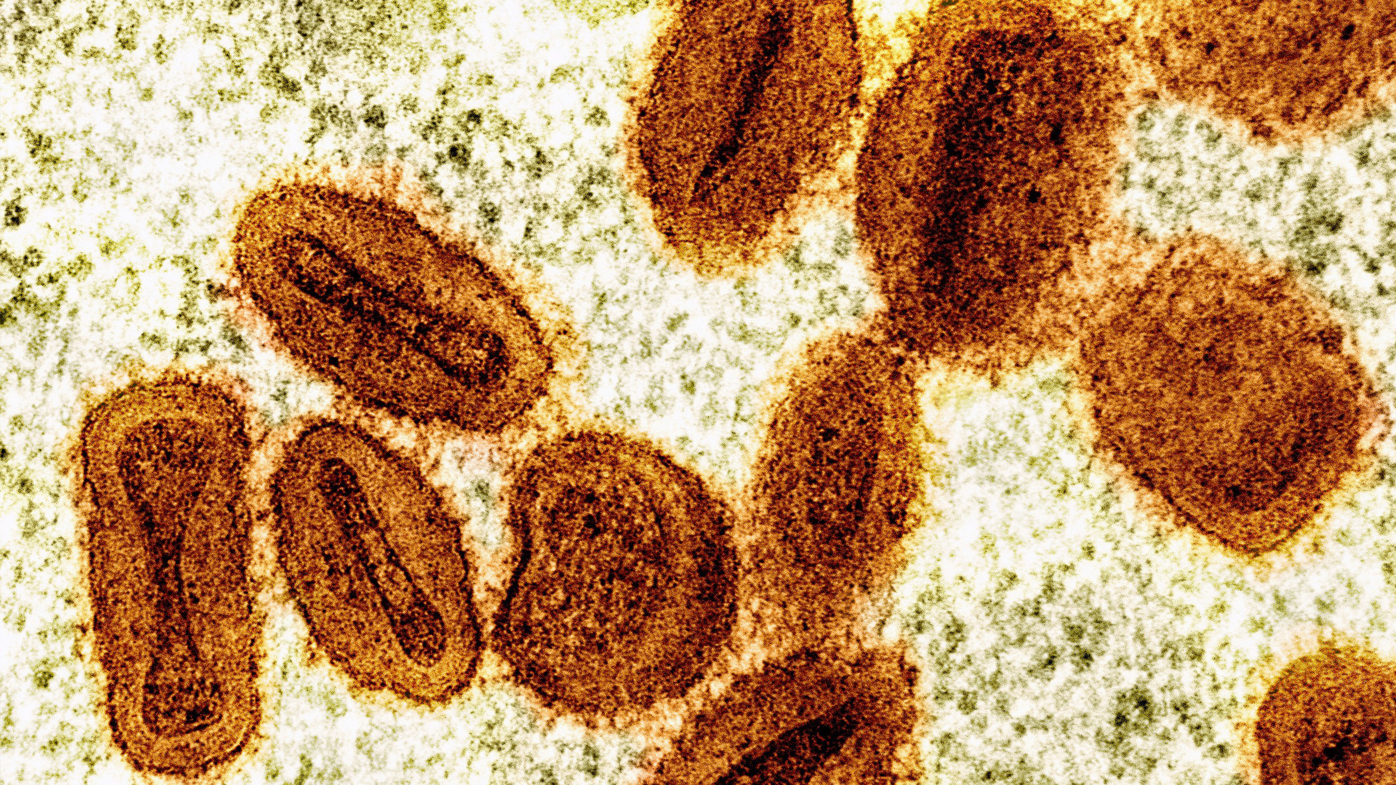 This colorized electron microscope image provided by the National Institute of Allergy and Infectious Diseases in 2024 shows Mpox virus particles, orange, found within infected cells, green. 