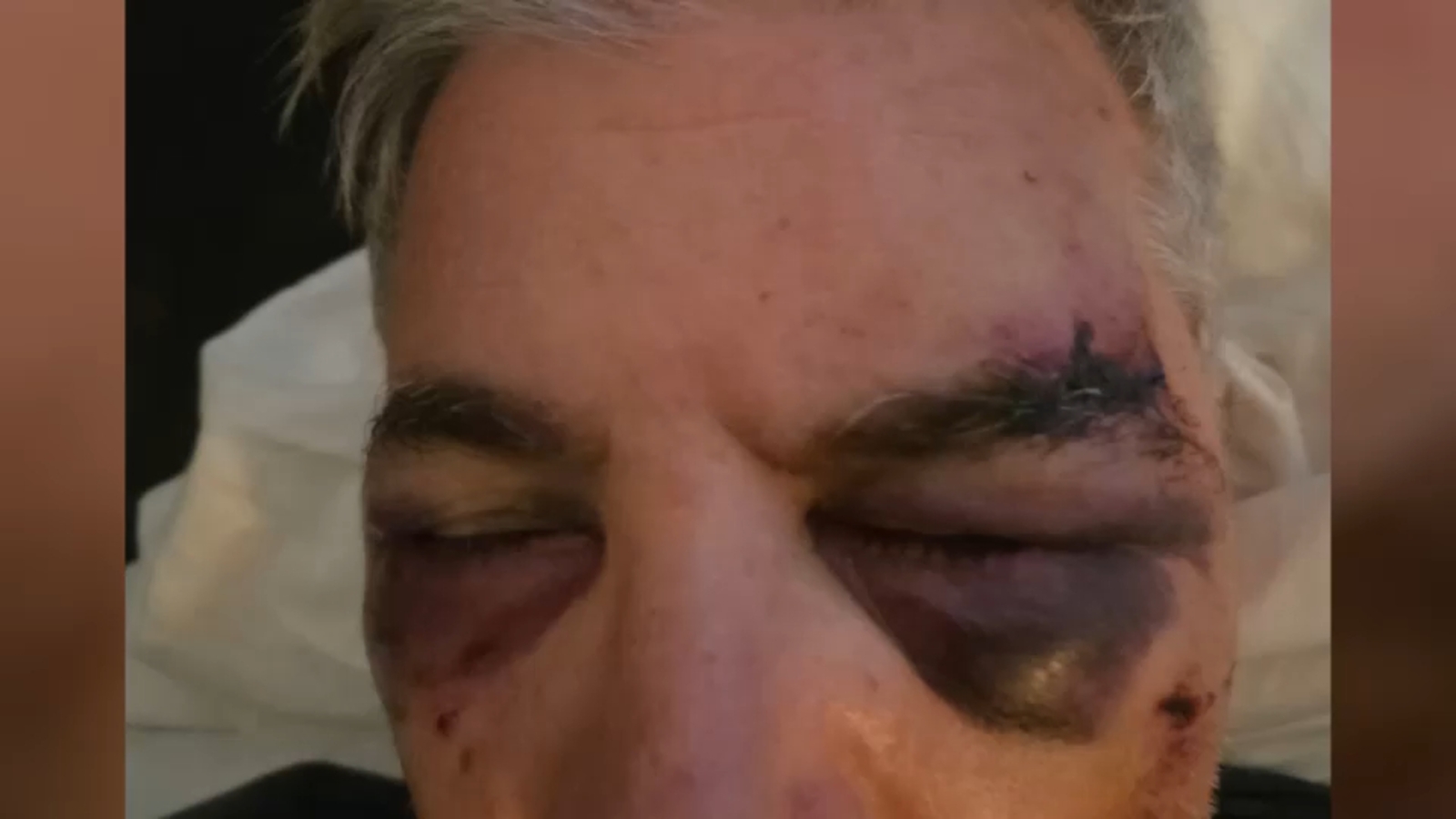 Father, son attacked outside hotel in San Antonio after Knicks championship win