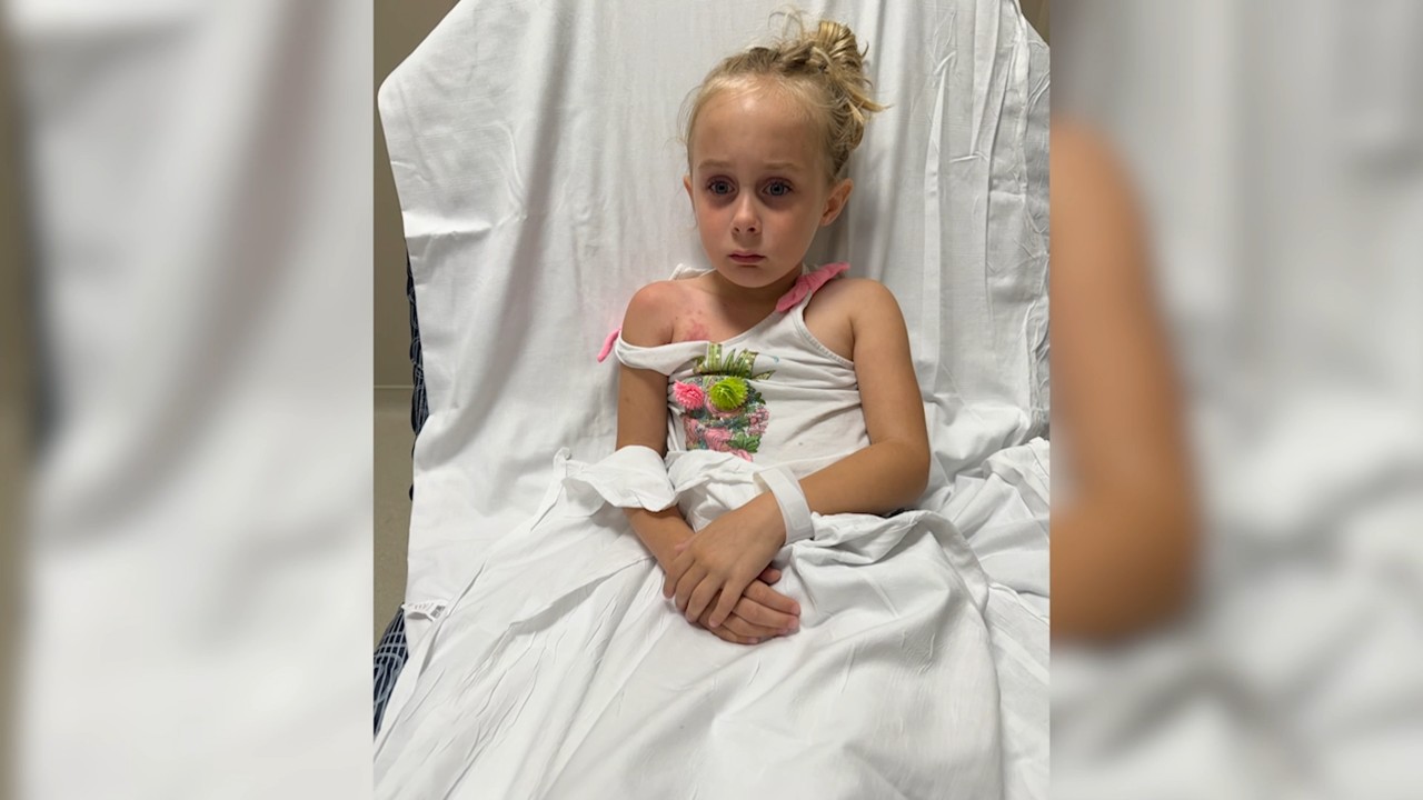 6-year-old stung by clinging jellyfish in New Jersey river