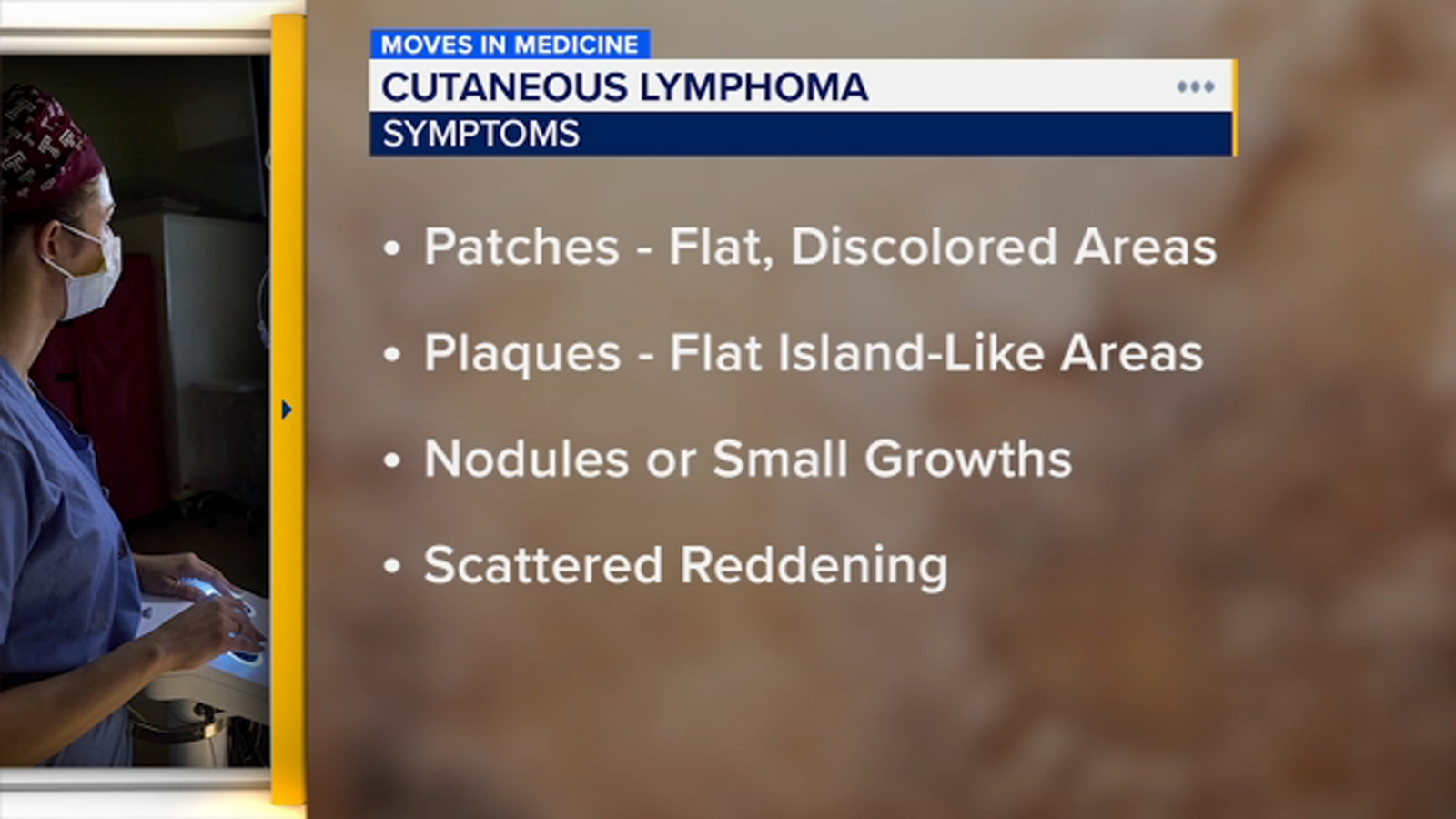 Philadelphia Rash Rash that won't go away could be cutaneous lymphoma | Moves in Medicine ...