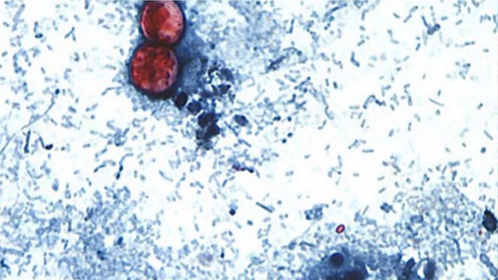 Cyclospora cayetanensis is a unicellular parasite that causes an intestinal infection called cyclosporiasis.