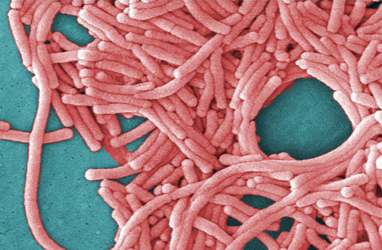 City investigates two Legionnaires' cases on Upper East Side; officials assure public water and cooling systems remain safe