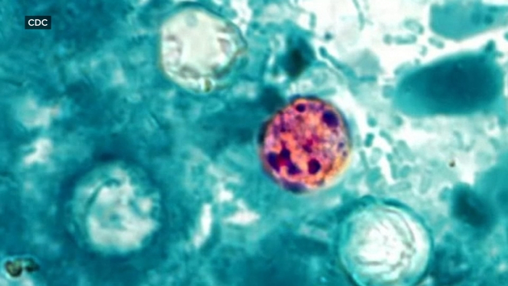 Parasitic infection, cyclosporiasis, cases reported in NC