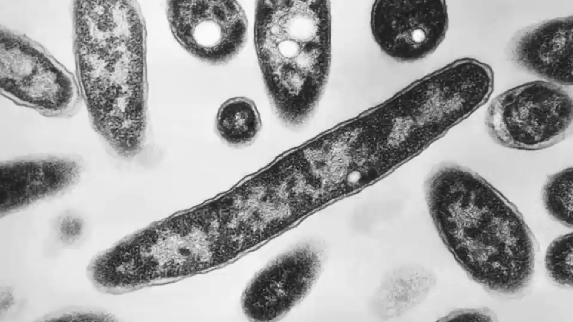 Officials search for source of Upper East Side Legionnaires' outbreak linked to 36 cases