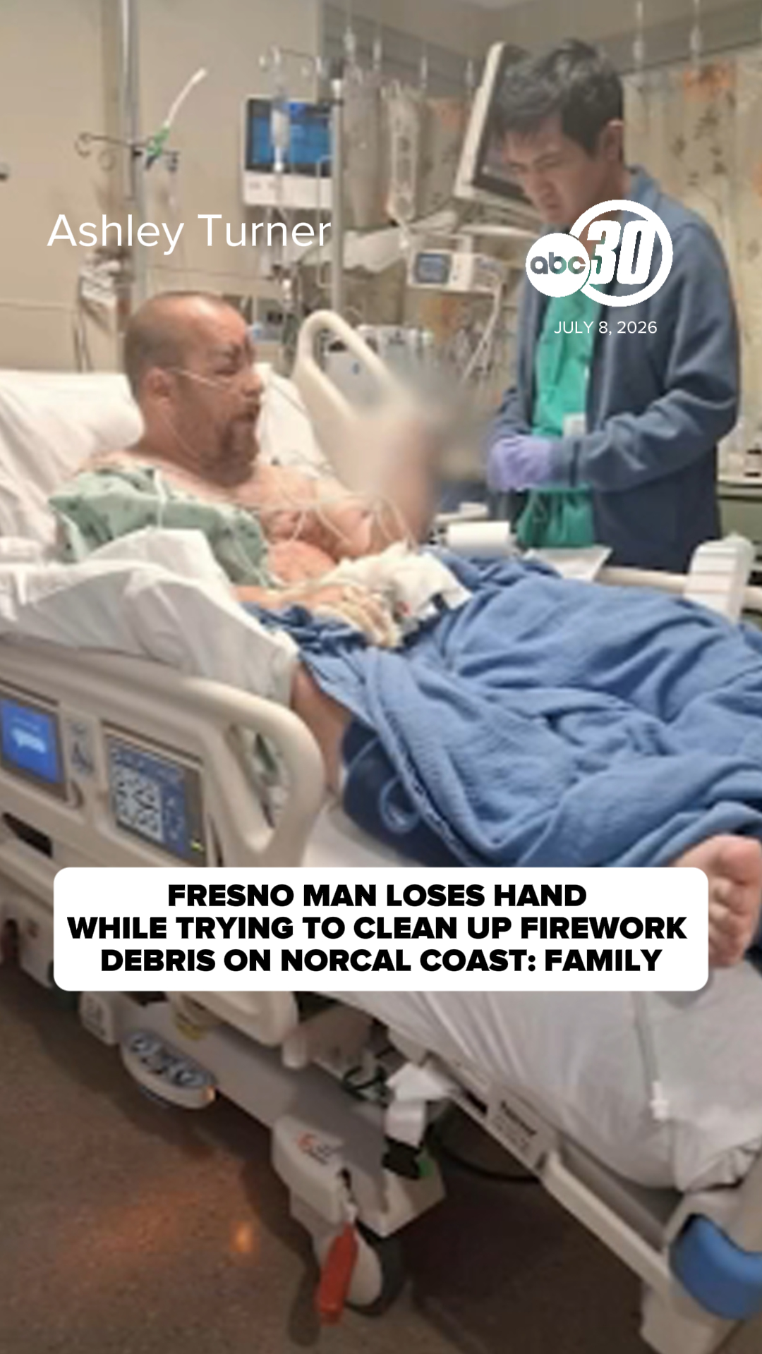 Fresno man loses hand trying to clean up firework debris, family says