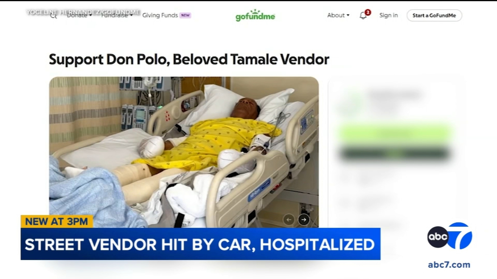 Street vendor severely injured after being hit by car while selling tamales in South LA Street vendor severely injured after being hit by car while selling tamales in South LA